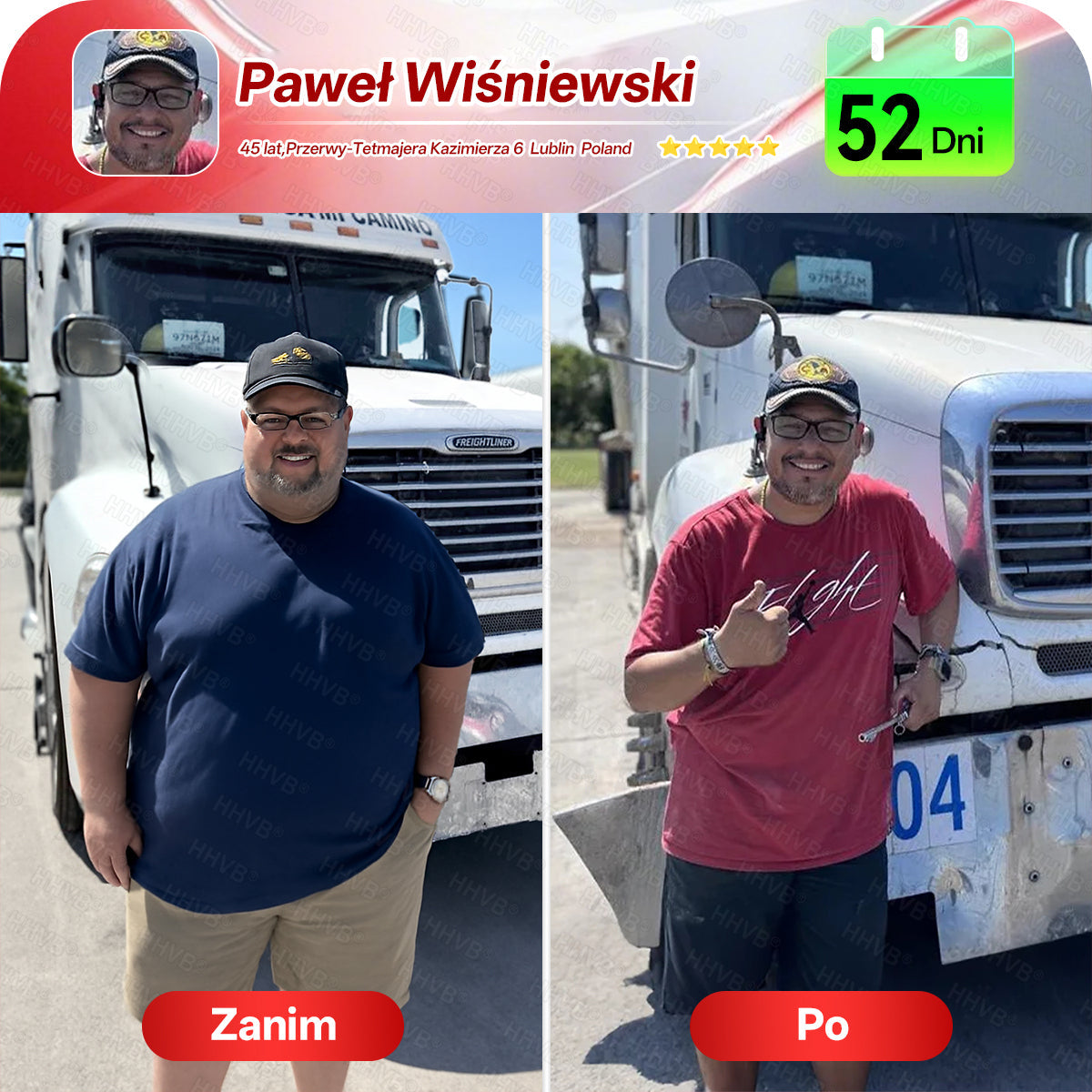 Oficjalny Sklep 𝐇𝐇𝐕𝐁®🌿 GLP-1 + Peptydy Kolagenowe – płyn doustny wspierający odchudzanie i ujędrnianie skóry 🔥 Wzbogacony o Matrixyl 3000, pomaga przy ✅ otyłości, poprawie jędrności skóry, wsparciu serca, cukrzycy, bezdechu sennym i problemach ze stawami.