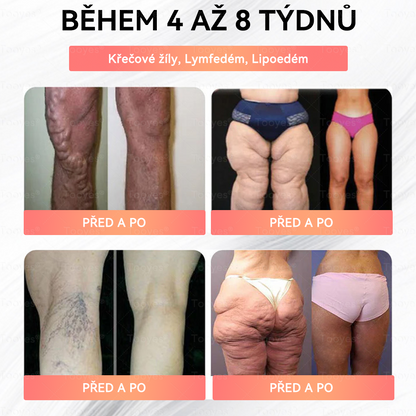 🔥Tooyes® GLP-1 tekuté perly s vysokou koncentrací - s obsahem NAD+, moringy a HCA (hubnutí, proti stárnutí, podpora střev a imunitního systému, rovnováha hladiny cukru v krvi, zdraví srdce a mozku)⚡