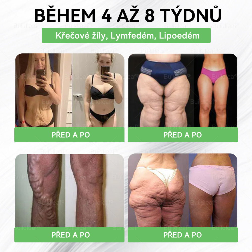 BuildLeafe® GLP-1 8-in-1 Fit & Vital Szájhigiéniai oldat Alkalmas elhízás, szív- és érrendszeri egészség, cukorbetegség, alvási apnoe, bélrendszeri egészség, ízületiproblémák és egyéb egészségügyi igények esetén